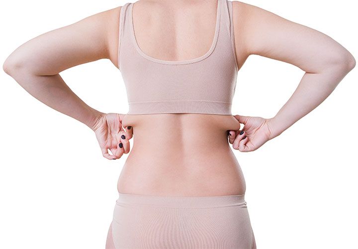 Female liposuction flanks