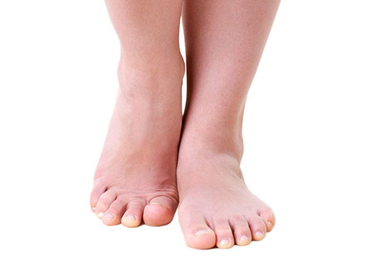 Female liposuction ankles