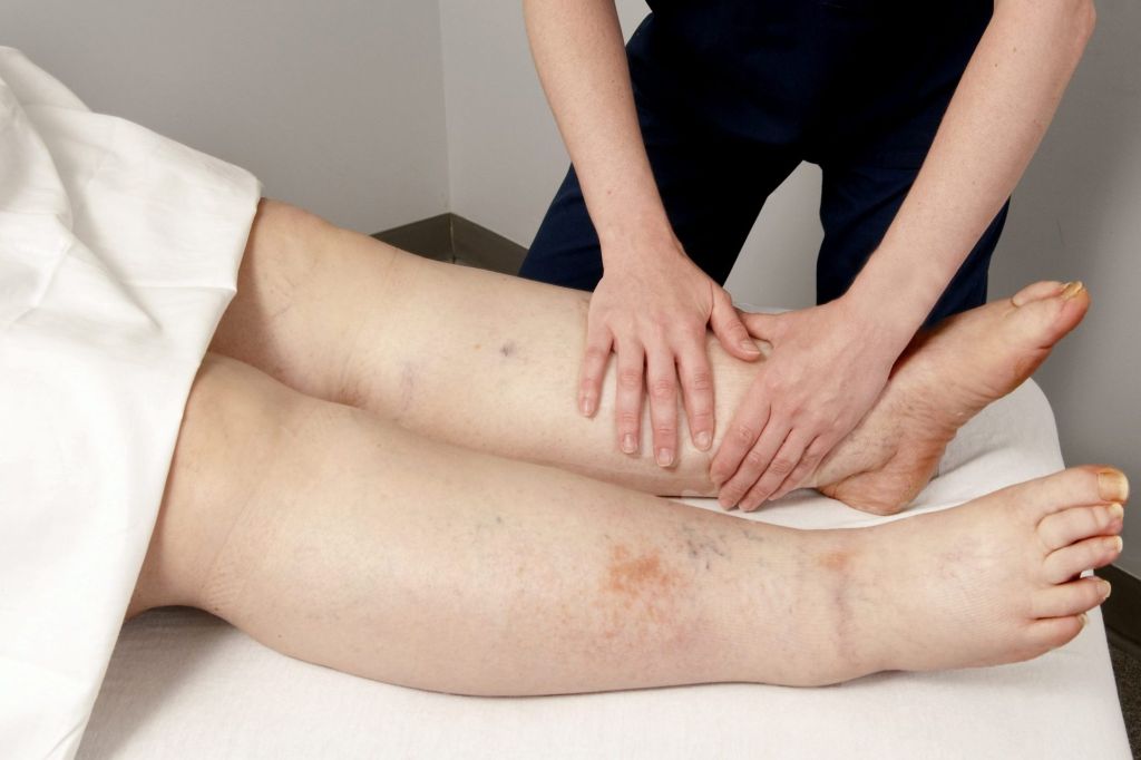 Leg Swelling | Causes & Treatment | Auckland NZ - Palm Clinic